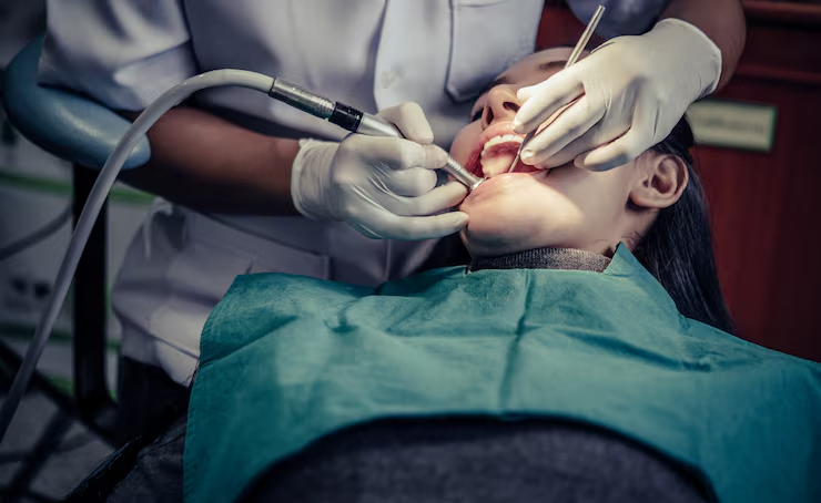 Wisdom Tooth Removal service at Himalaya Dental House
